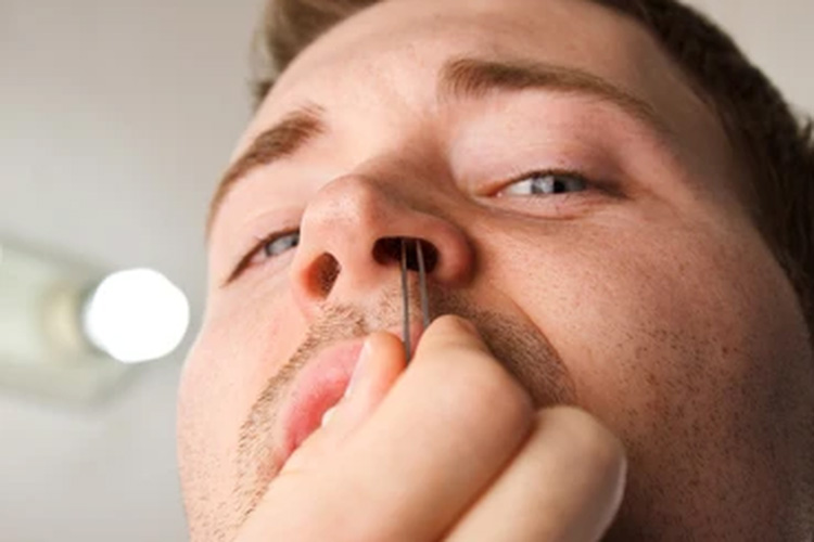 Mencabut bulu hidung (MCarper, Shutter Stock, kompas