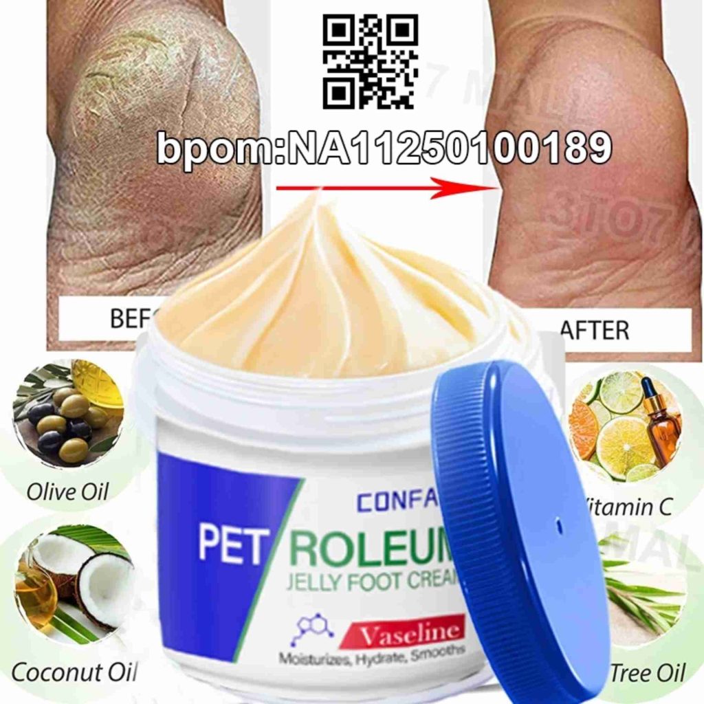 Review Krim Kaki Pecah Pecah Terbaik 2026 Solusi Ampuh untuk Tumit Kering dan Retak