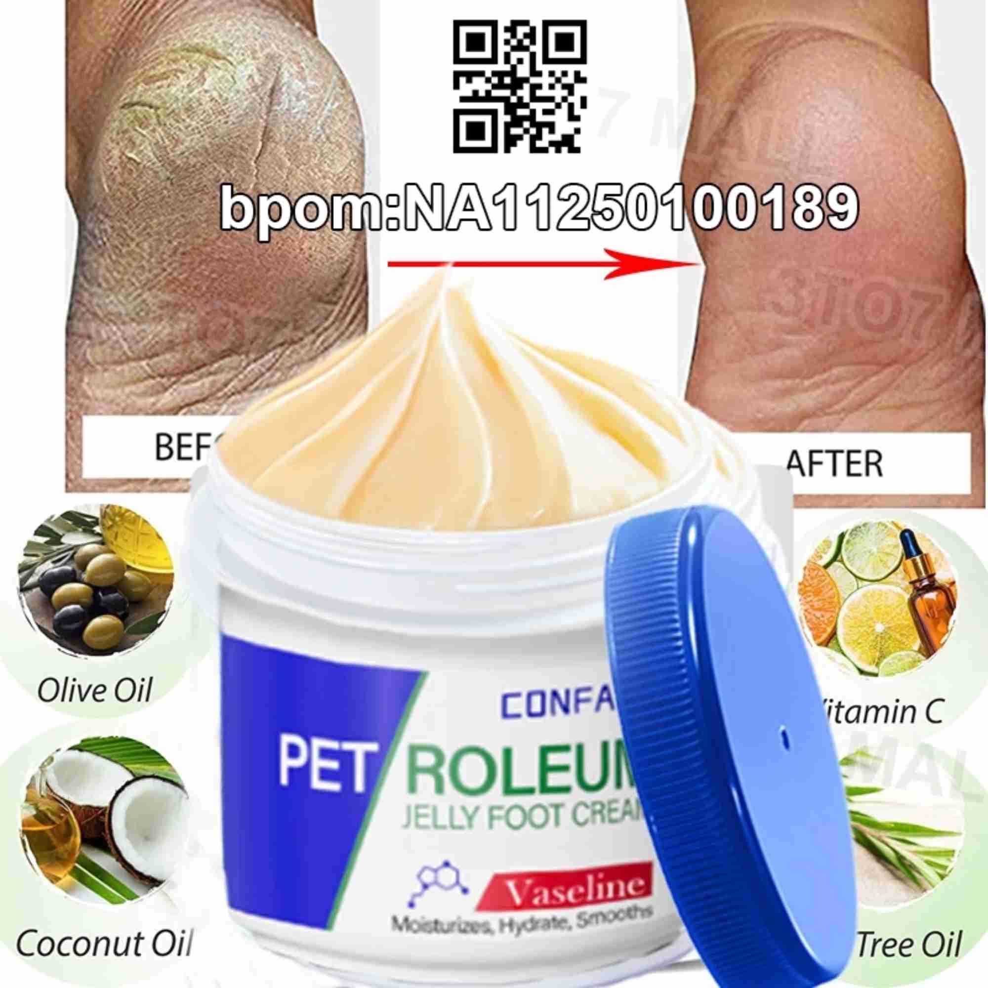 Review Krim Kaki Pecah Pecah Terbaik 2026 Solusi Ampuh untuk Tumit Kering dan Retak